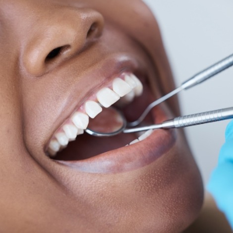 Close up of a dental mirror in a patient's mouth