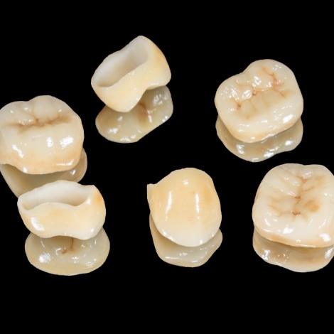 Several metal free dental crowns against black background