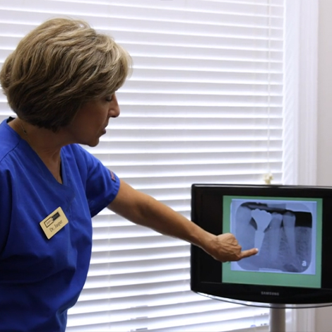 Dentist showing a patient an x ray of dental implants in Fort Mill