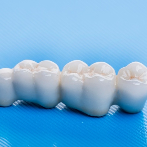 Dental bridge against blue background