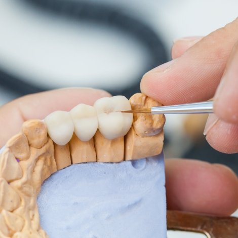 Dentist designing a dental crown