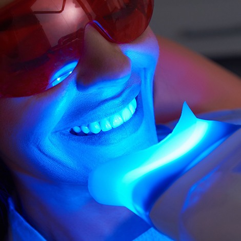 In-office teeth whitening in Fort Mill, SC